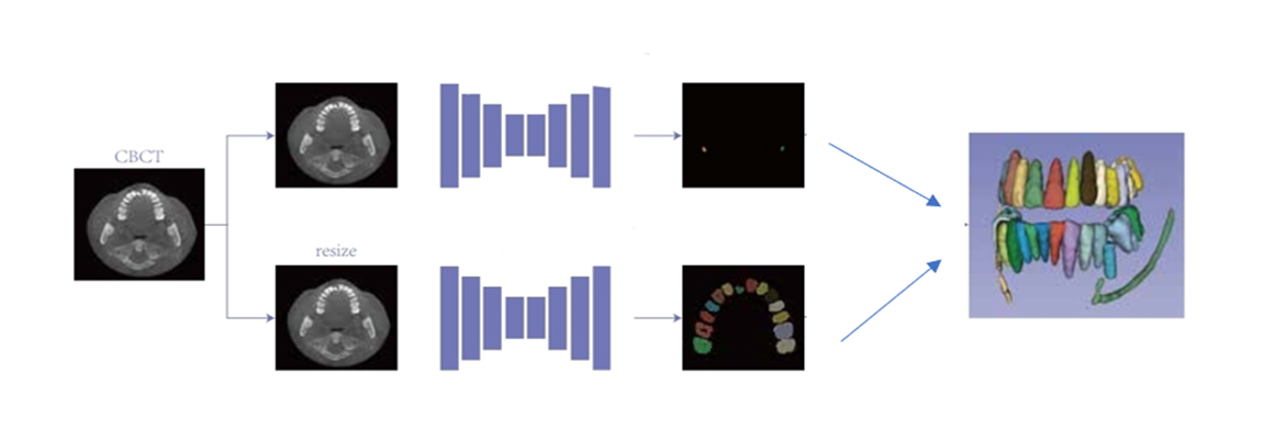 graphic representation of the 3D tooth segmentation algorithm pipeline